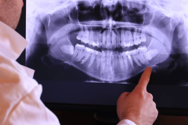 Best Cracked Tooth Emergency Dentist  in Conyngham, PA